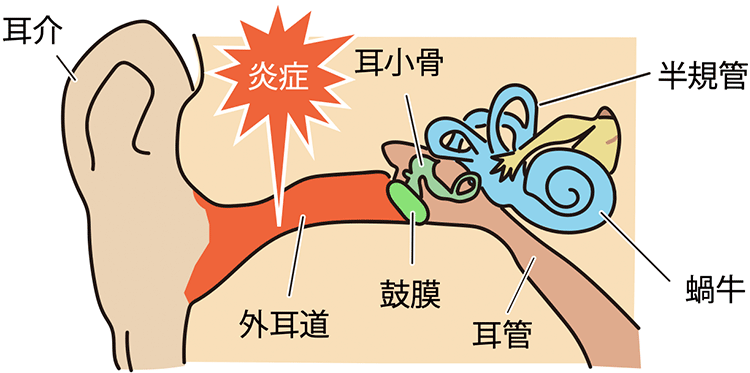 図