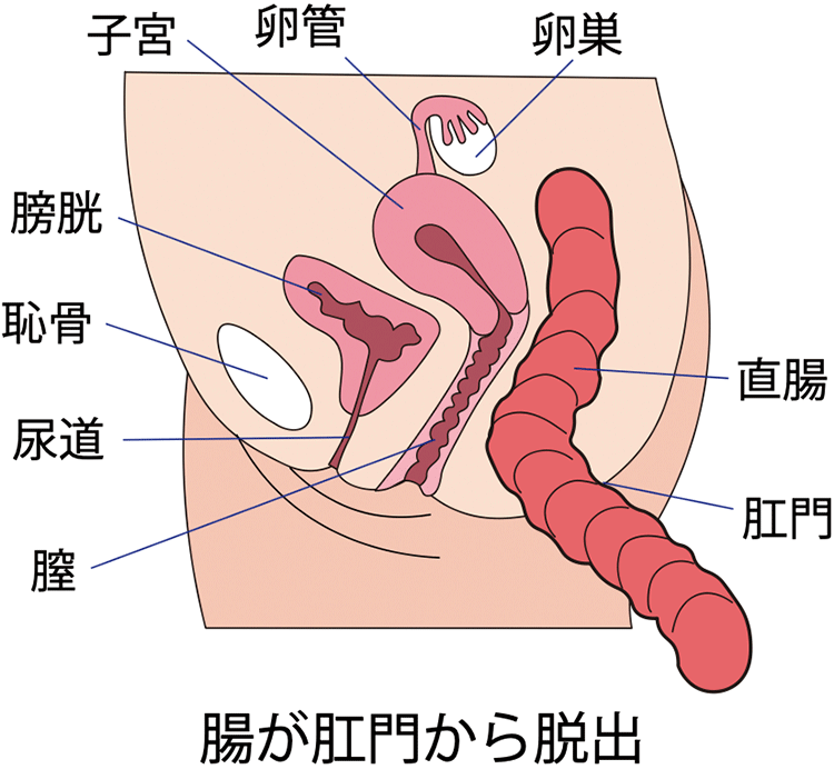 図