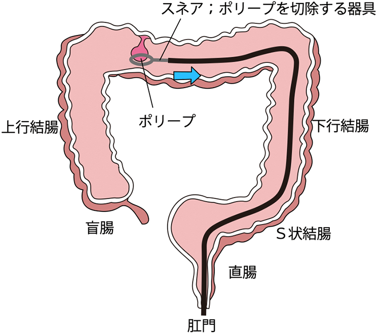 図