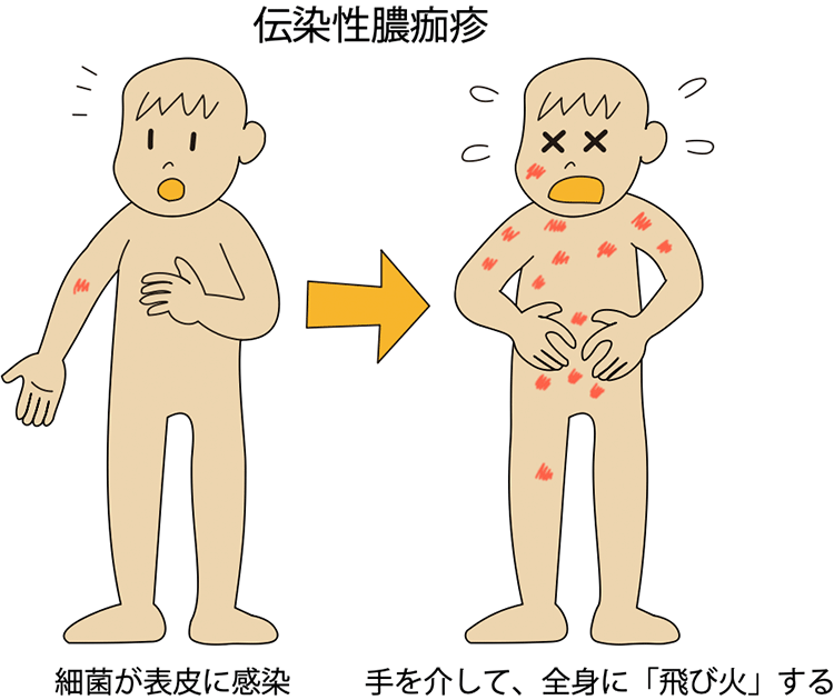 図