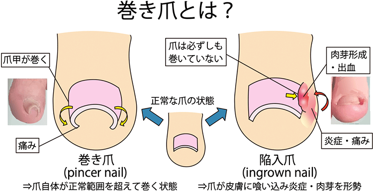図