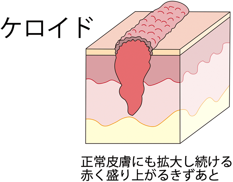 図