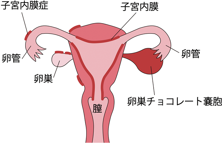 図