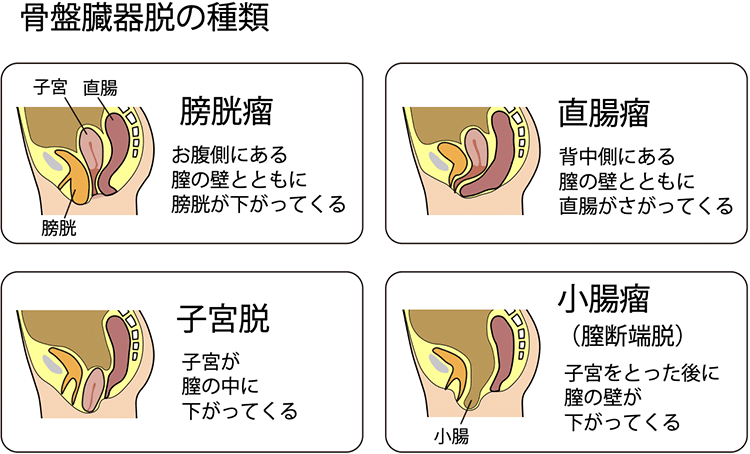 図