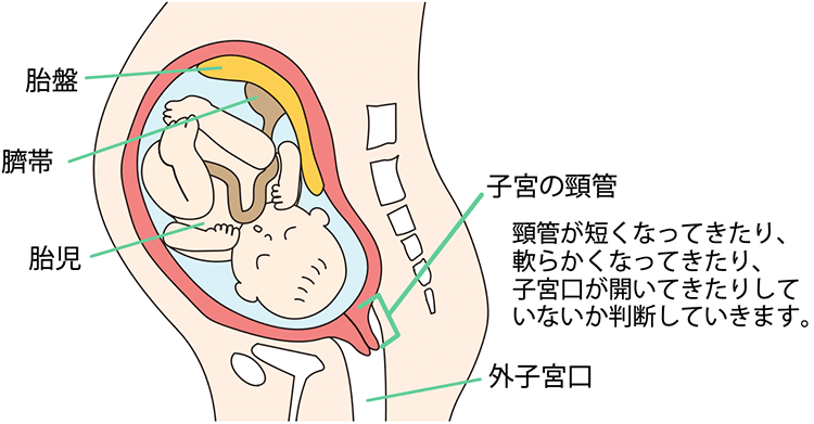 図