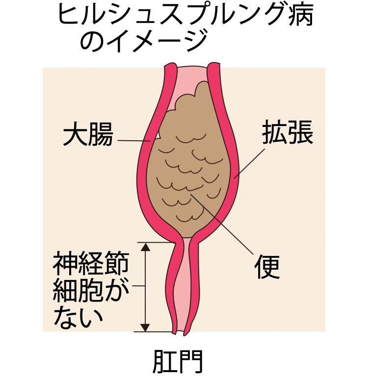 図