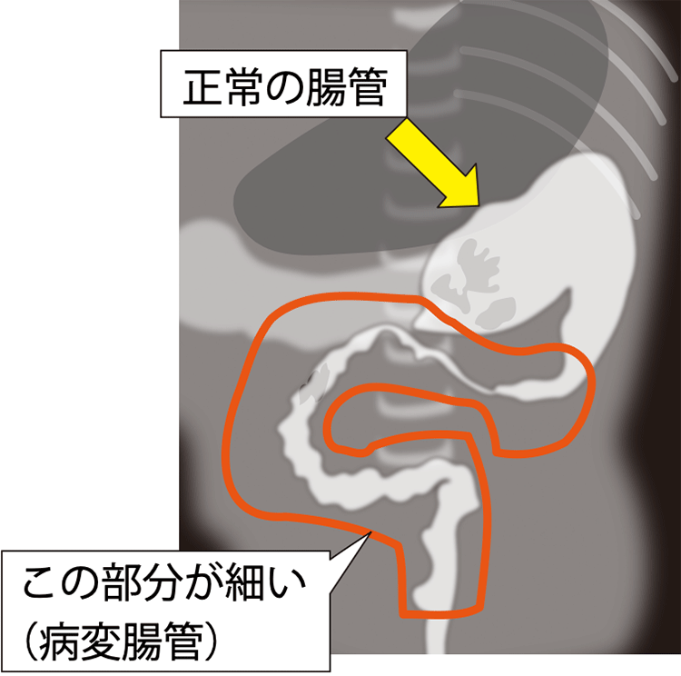 図