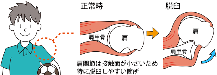図